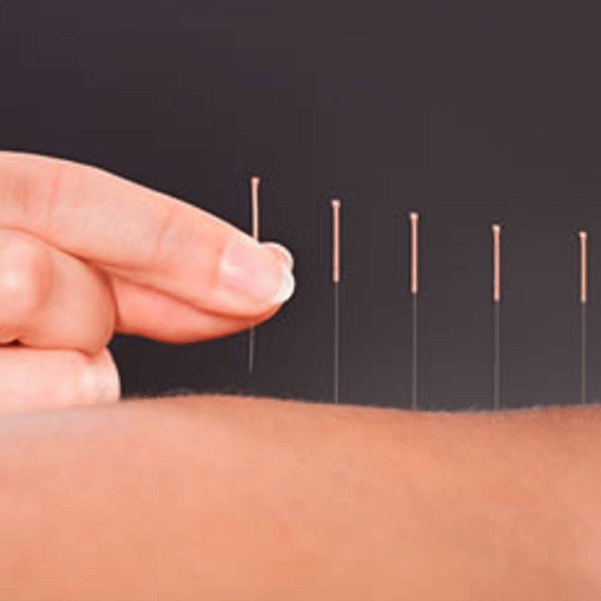 TCM Acupuncture Diploma